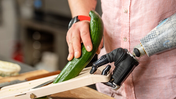 Ottobock Bebionic Biyonik Protez Kol